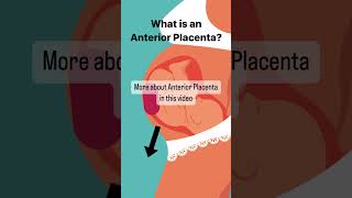 What is Anterior Placenta pregnant [upl. by Yrocej]