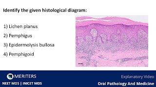 NEET MDS  INICET  OPM  Skin And Vesiculobullous Lesions  Explanatory Video  MERITERS [upl. by Haroppiz793]