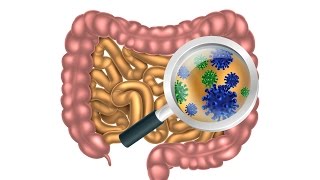 6 Steps to Heal Leaky Gut and Autoimmune Disease Naturally [upl. by Annoyek]