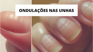 O QUE CAUSA ONDULAÇÕES NAS UNHAS  rafatododia [upl. by Venuti]