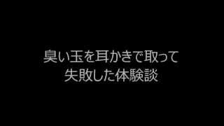 くさい玉（膿栓）の取り方｜簡単に耳かき で取って失敗した体験談５ [upl. by Rebba723]