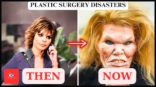 50 Celebrity Plastic Surgery Disasters  Then and now 2025 [upl. by Cilla]