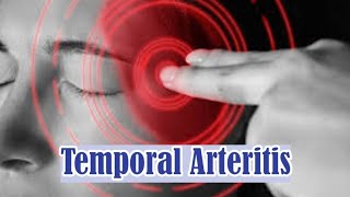 Temporal Arteritis  Giant Cell Arteritis  Symptoms Causes Complications and Treatment [upl. by Idell670]