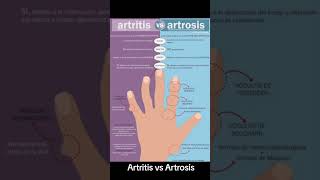 Artritis vs Artrosis [upl. by Cornell]