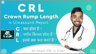 crl means in pregnancy  crl kya hota hai  crl in ultrasound report  crown rump length 6 weeks [upl. by Tressia976]