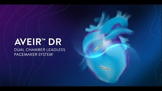 AVEIR DR™ Dual Chamber Leadless Pacemaker System 3D Implantation Simulation [upl. by Llenehs702]