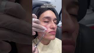 What is SCULPTRA for  Dr Medispa [upl. by Ennaul157]