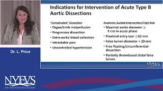 When and how to treat acute type B aortic dissection Lucyna Price Session II Aortic Dissections [upl. by Rengia376]