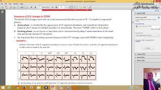 17 Ischemic Heart Diseases ProfDrmahmoud Allam [upl. by Homer]