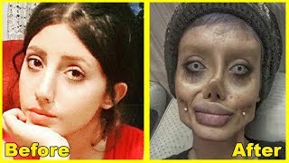 Sahar Tabar  Before amp After Plastic Surgery  Corpse Bride [upl. by Ventre]