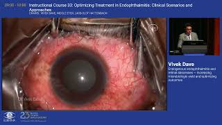 5 Endogenous endophthalmitis and retinal abscesses — increasing microbiologic yield and [upl. by Pelagias]