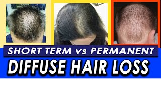 Permanent vs Temporary Diffuse Hair Loss and Telogen Effluvium How to differentiate [upl. by Aisena]