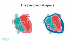 Ultrasound Guided Pericardiocentesis [upl. by Pages]