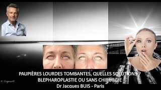 PAUPIERES LOURDES TOMBANTES  QUELLES SOLUTIONS  AVEC BLEPHAROPLASTIE OU SANS CHIRURGIE Dr BUIS J [upl. by Hannazus]