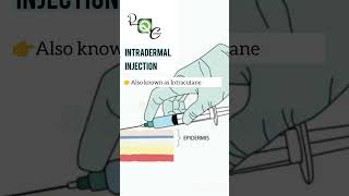 INTRADERMAL INJECTION pharmacy nursing neet science biology [upl. by Sidran]