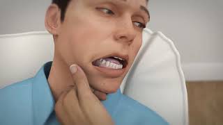 Buccal Midazolam Training Video [upl. by Arjun118]