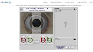 Astigmatismo Miope  Tutorial Retinoscopia [upl. by Oahc]