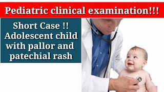 FCPS Pediatric clinical examination fcps shortcase cpsp paeds aplasticanemia fanconianemia [upl. by Chicoine]