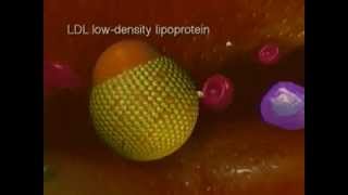 Biology of progression of atherosclerosis [upl. by Danczyk]