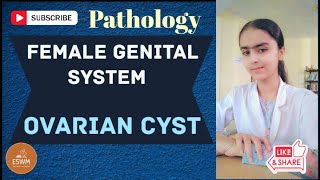 Ovarian Cyst PATHOLOGY Explained [upl. by Veradi451]