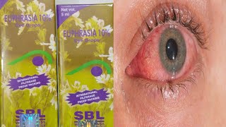 EUPHRASIA EYE DROPS  यूफ्रेसिया आंख का ड्रॉप हिंदी में  EUPHRASIA EYE DROPS IN HINDI [upl. by Auqinet253]