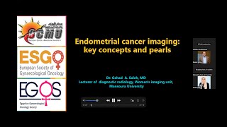 Endometrial cancer imaging Key concepts and pearls Dr Gehad Saleh [upl. by Ariahaj228]