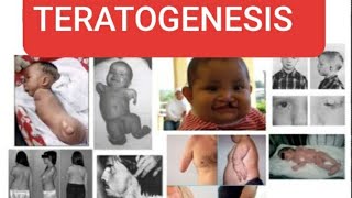 TERATOGENESIS Teratogenic agents and their effects on developing embryo [upl. by Kung218]