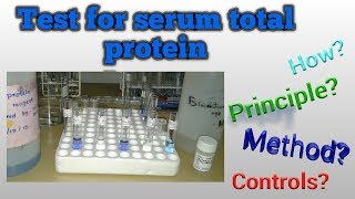 Serum protein test [upl. by Kimberli]