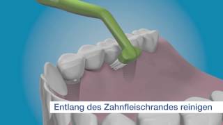 TePe Implant Care  für die Reinigung der Innenflächen des Implantats [upl. by Asyar]