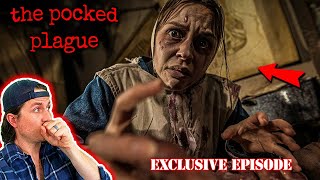 MrBallen Podcast  The pocked plague PODCAST EXCLUSIVE EPISODE [upl. by Aneej]