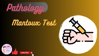 Mantoux Test [upl. by Nnair]