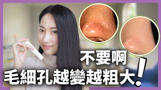 【這才是根部解決】臨床研究認證有效清除痘痘粉刺DrGrace [upl. by Pruchno654]