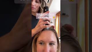 Scalp Cleanse For Dry Flaky Scalp shorts [upl. by Adrahs260]