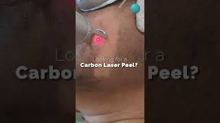 Looking for Carbon laser peel [upl. by Conti412]