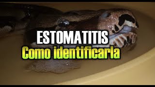 Estomatitis  Como Identificarla [upl. by Ignace]