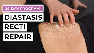 28Day Diastasis Recti Repair Program FREE Challenge [upl. by Seto]