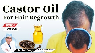 Is Castor Oil Good For Hair Growth  बाल Regrowth के लिए Castor Oil का उपयोग करे  Dr Anil Garg [upl. by Ennasus946]