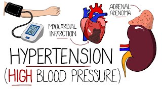 Hypertension Explained High Blood Pressure  Includes Hypertensive Emergency amp NICE Guidelines [upl. by Pittel]