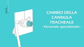 Cambio della cannula tracheale per il personale infermieristico  Fahl MedizintechnikVertrieb GmbH [upl. by Linet]