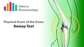 Rheumatology KNEE exam Sweep Test for Joint Swelling or Effusion [upl. by Noonan240]