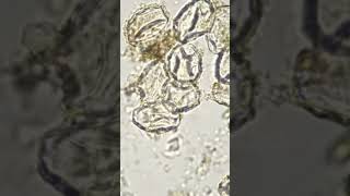 Eggs of Taenia solium Tapeworm under microscope [upl. by Henka277]