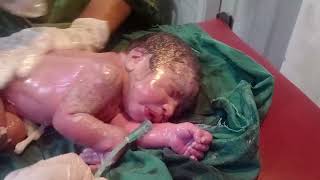 New born baby survive after efforts and now active thanks God baby clean now and need oxygen still 🥰 [upl. by Aihsotan]