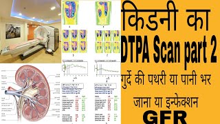 Kidney ka DTPA Scan part 2 Hindi USG CT Scan abdomen Durde ki jaach Awerenes of all [upl. by Pallas332]