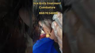 how to remove nits and lice nits hair nitsremoval peenu hairstyle lice lice treatment eeru [upl. by Nallac]