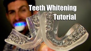 Home Teeth Whitening Tutorial  How To Whiten Your Teeth At Home For Best Results [upl. by Adnarahs]