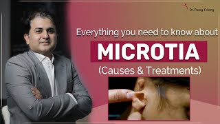 What is Microtia Microtia causes and how to treat it  Designer Bodyz  Dr Parag Telang [upl. by Weigle208]