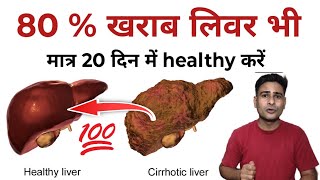 लिवर सिरोसिस गांठे आकार छोटाबड़ा या Infection सिर्फ 20 दिन में ठीक करें  Ayurnitin Ayurveda [upl. by Woodley377]