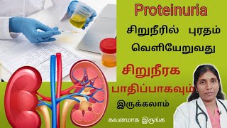 சிறுநீரில் புரதம் போவதால் காணப்படும் அறிகுறிகள் Proteinuria causes and symptoms [upl. by Onaicul]