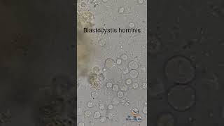 Blastocystis hominis in Stool [upl. by Iretak]