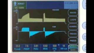 Newport e360 Ventilator Overview [upl. by Digdirb]